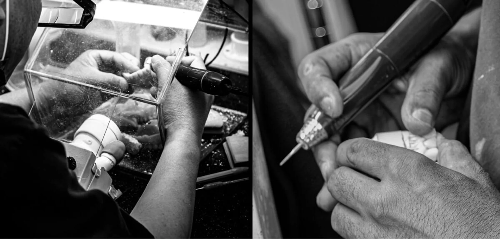 YM technicians shaping and finishing restorations by hand