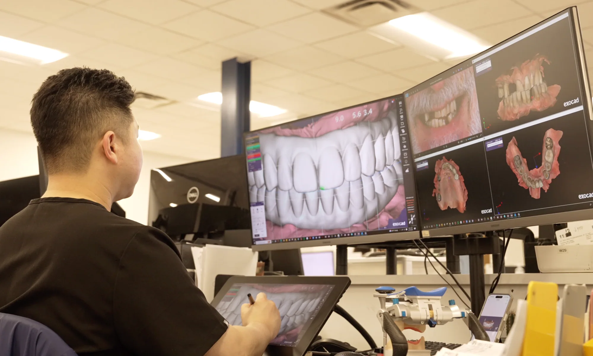 YM designer reviewing a restorative case in exocad