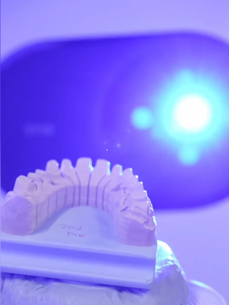 Dental model beneath the YM digital scanning light